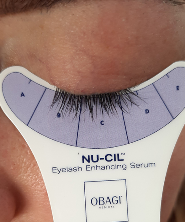 OBAGI NU-CIL через 8 тижнів